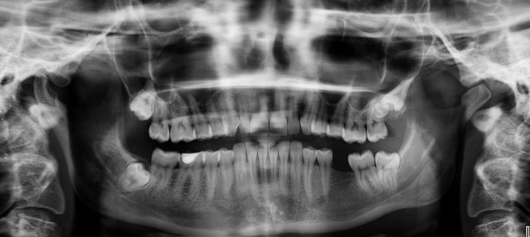 Evita multas ITV: Protege tu coche y evita consecuencias